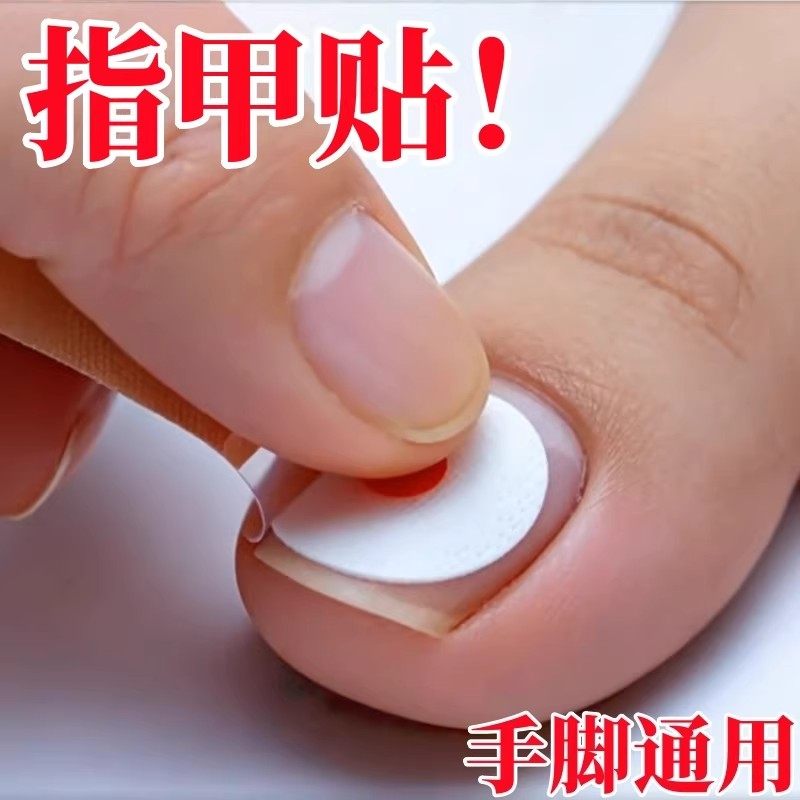 【香港断货王】灰趾增厚正品专用灰指贴发黄粉碎甲脚趾手指甲专用