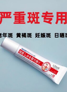 去斑霜祛老年斑专用脸部去手上手部手背的药膏强力去除正品