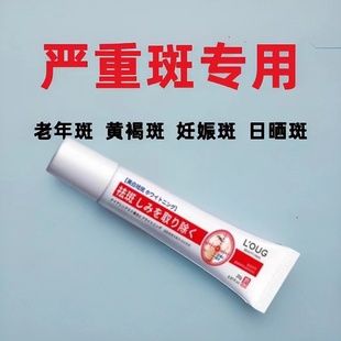 去斑霜祛老年斑专用脸部去手上手部手背的药膏强力去除正品