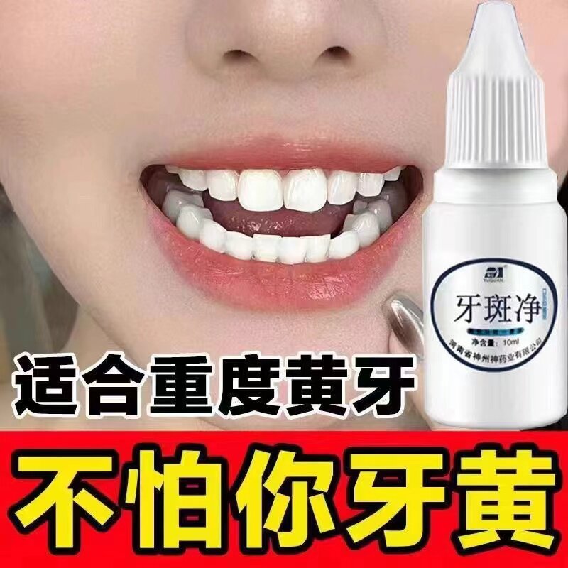 洁牙粉牙齿美白速效去黄牙黑斑去烟渍洗牙污垢茶渍牙菌斑祛除神器