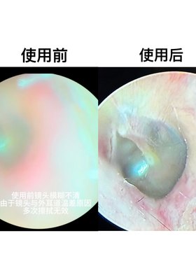 耳内镜镜头防雾液可视采耳专用