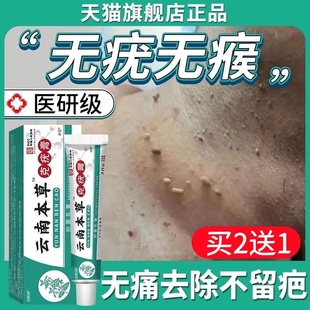 云南本草克疣膏去疣瘊药膏水尤瘊子小肉粒扁平去除膏一抹灵无忧