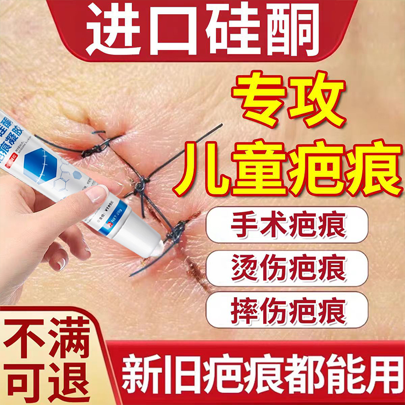 祛疤膏儿童专用小孩摔伤去疤痕修复除疤膏第一名增生凸起去除疙瘩
