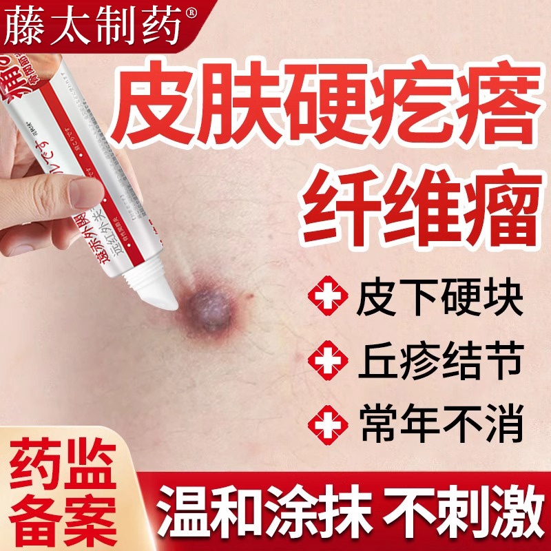皮肤硬疙瘩纤维瘤去除搭膏药贴皮下疙瘩硬块结节痘神脂肪瘤器肿