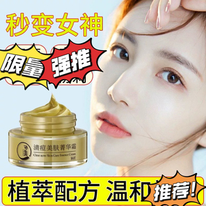 去痘印修复痘坑去粉刺去痘神器