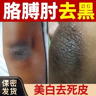 磨砂膏美白去黑色素关节膝盖手肘脖子腋下屁股去黑坐印大腿内侧