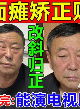 现货速发面瘫药一侧半张脸部表情肌神经麻痹瘫痪神器嘴歪眼斜膏贴