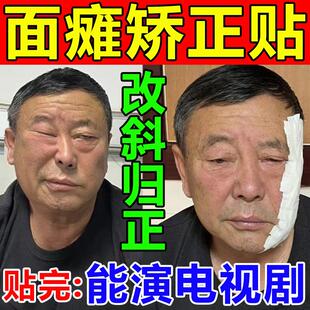 现货速发面瘫药一侧半张脸部表情肌神经麻痹瘫痪神器嘴歪眼斜膏贴
