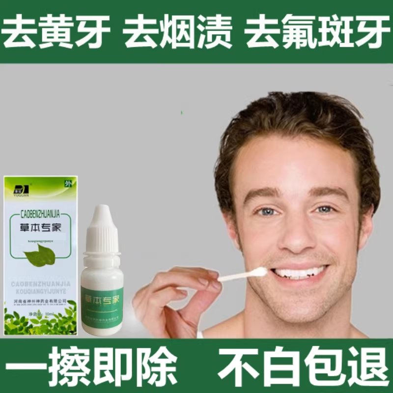洗牙液牙齿污垢清洁神器去牙渍牙菌斑去除黄牙烟渍氟斑牙洗牙药水
