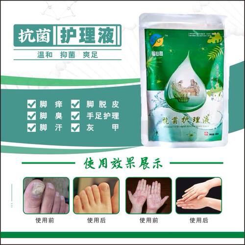 护理液止痒脱皮助康刘先生竹醋