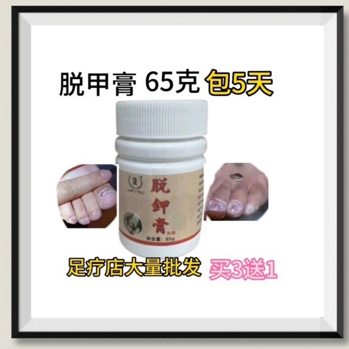 脱甲膏65克无痛去甲包6天后用热水泡了修足疗店大量批发买3送1