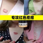 疤痕增生凸起软化去除瘢痕体质胸前红疙瘩烧烫手术后疤痕灵修复膏