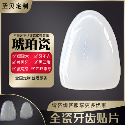进口正品VITA琥珀瓷手工瓷白玉瓷全瓷牙齿贴片牙贴面全国门店定制