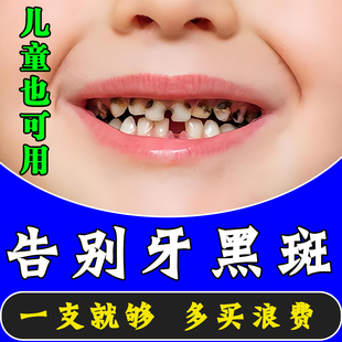 【20倍去渍】益生菌sp-4美白牙膏牙根发黑祛渍去黄清新口气去烟渍