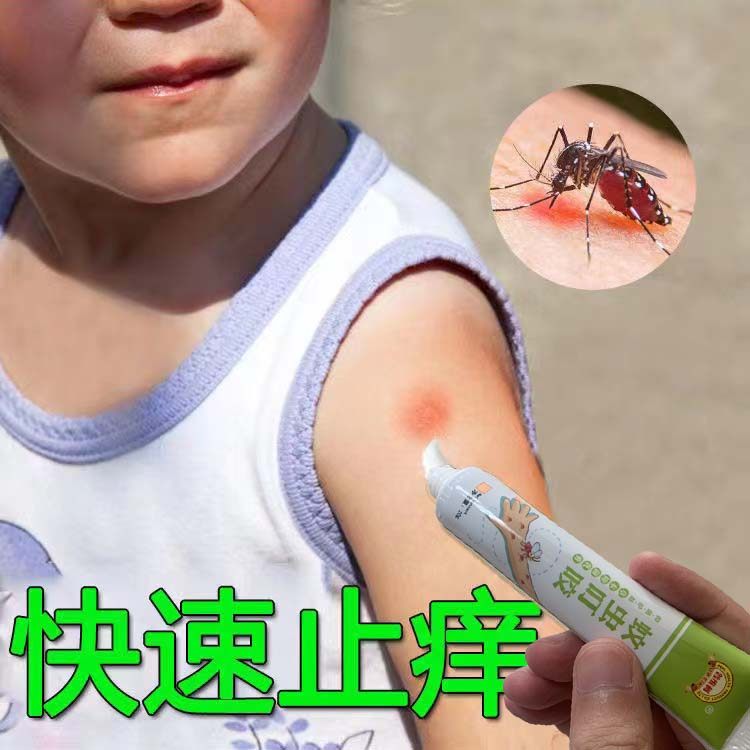 蚊虫叮咬止痒抑菌膏儿童宝宝婴儿专用夏天提神防暑驱虫驱蚊神器,婴童洗护,止痒膏,淘宝优惠券,粉丝福利购,淘宝优惠卷