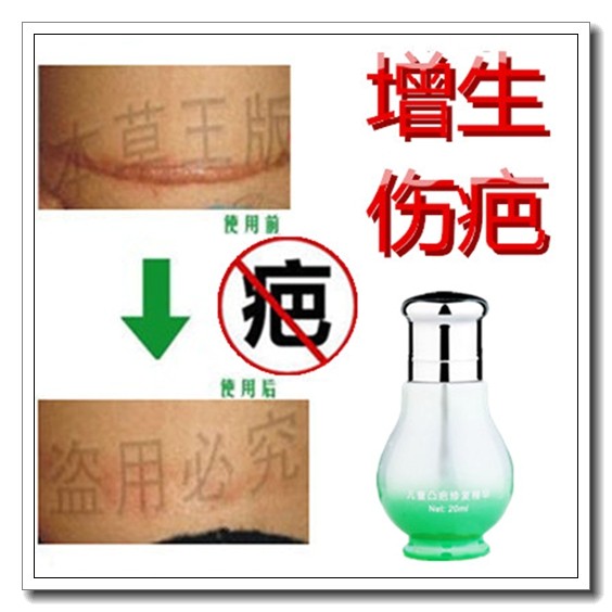 儿童淡疤护理去唇嘴角边黑色素斑点纹身软化去除手术缝针凹凸疤痕,洗护清洁剂/卫生巾/纸/香薰,其它,淘宝优惠券,粉丝福利购,淘宝优惠卷