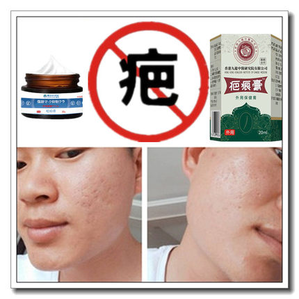 除增生修复疙瘩性突起缝针剖宫产伤疤痕印纹身手术抓伤色素沉着疤