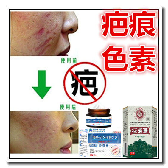 疤痕印正品去除黑色素沉淀去手术伤痕疙瘩淡化色素印沉着修复膏霜