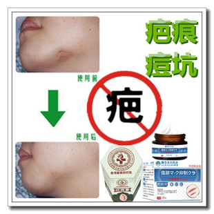 增生疙瘩修复液去凸疤祛除手术破腹产伤疤痕印灵缝针色素沉淀药膏