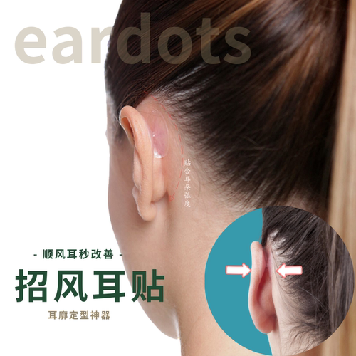 欧美热卖招风耳贴高粘性更隐形