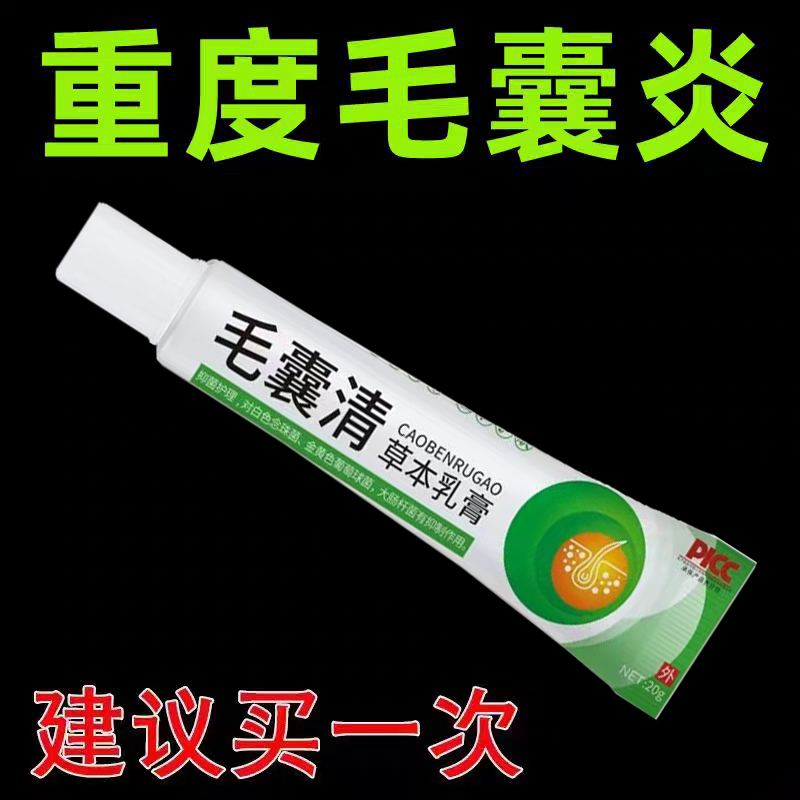 毛囊炎头上长痘痘脓包疙瘩头癣毛囊发炎堵塞抑菌止消炎乳膏