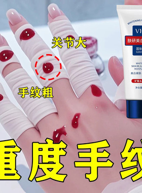 【小红书同款】重度手纹提亮美手精华霜纤长手指变细去褶皱护手霜