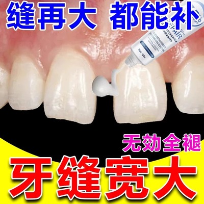 牙缝宽大修复神器补牙缝牙膏填充门牙牙缝大矫正防堵蛀牙牙洞清理