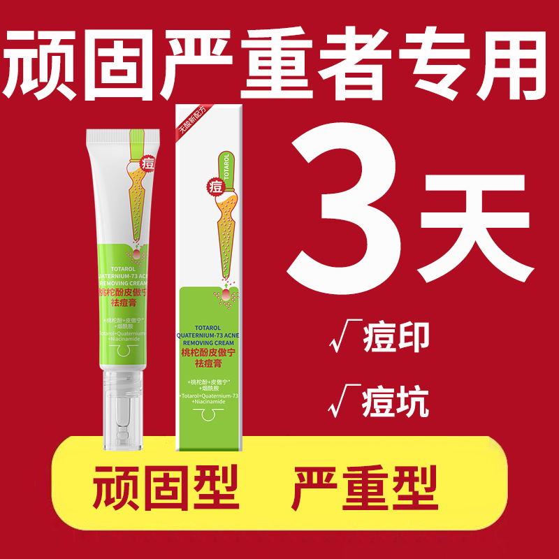 祛痘印复修淡化痘印祛痘膏去痘印痘坑痘疤炎红肿凹洞消