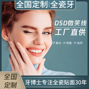 全国定制进口全瓷贴面全瓷美牙美白连桥牙马里兰桥连冠微贴片