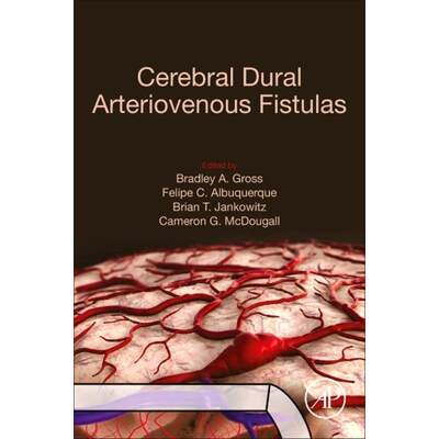 【4周达】Cerebral Dural Arteriovenous Fistulas [9780128195253]