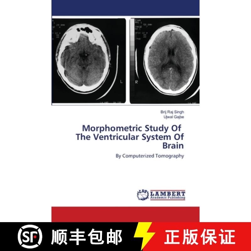 预订 Morphometric Study Of The Ventricular System Of Brain [9786202518109]