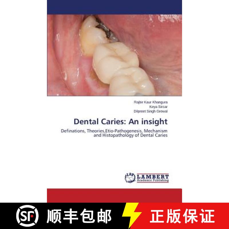 预订 Dental Caries: An insight [9783659637933]