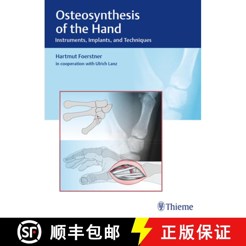 【3-4周达】Osteosynthesis of the Hand: Instruments, Implants, and Techniques [9783132038110]