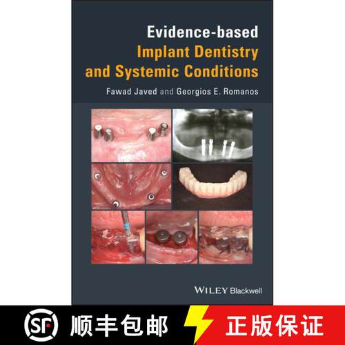 【3-4周达】精装 Evidence-Based Implant Dentistry And Systemic Conditions [Wiley牙科医学] [9781119212249]