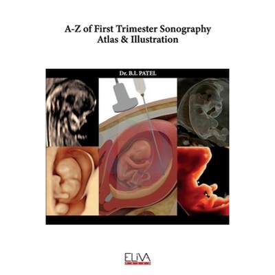 【4周达】A-Z of First Trimester Sonography Atlas & Illustration [9781636481968]