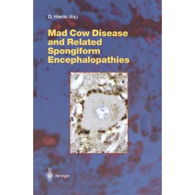 【4周达】Mad Cow Disease and Related Spongiform Encephalopathies [9783642057564]