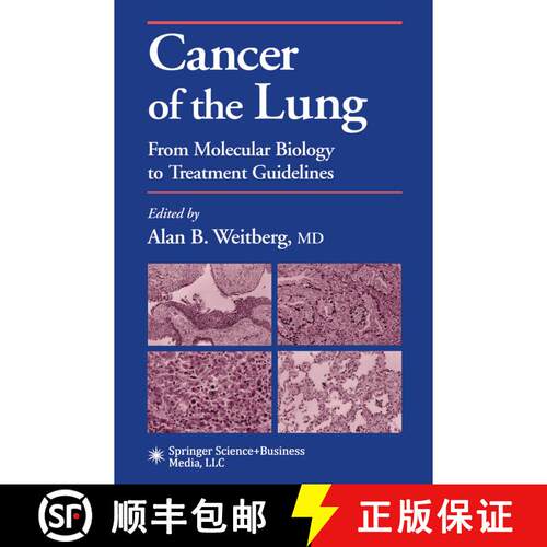 【3-4周达】Cancer of the Lung: From Molecular Biology to Treatment Guidelines [9781617372094]