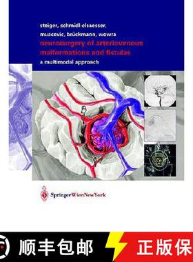 【3-4周达】Neurosurgery of Arteriovenous Malformations and Fistulas: A Multimodal Approach [9783211837030]