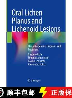 【3-4周达】Oral Lichen Planus and Lichenoid Lesions: Etiopathogenesis, Diagnosis and Treatment [9783031297649]