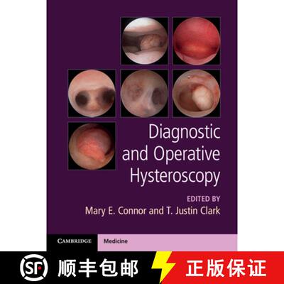 预订 精装 Diagnostic and Operative Hysteroscopy [9781107111608]