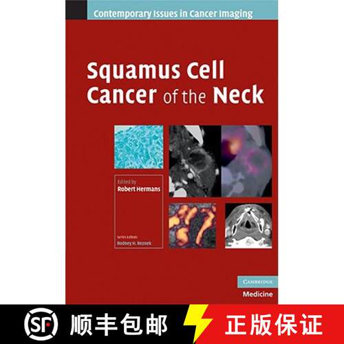 【3-4周达】精装 Squamous Cell Cancer of the Neck: - Squamous Cell Cancer of the Neck [9780521886918]