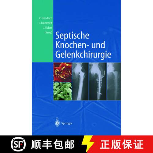 【3-4周达】Septische Knochen-und Gelenkchirurgie [9783642639289]