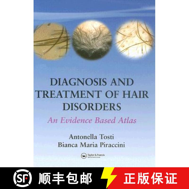 【3-4周达】Diagnosis and Treatment of Hair Disorders: An Evidence-Based Atlas [9781841843407]