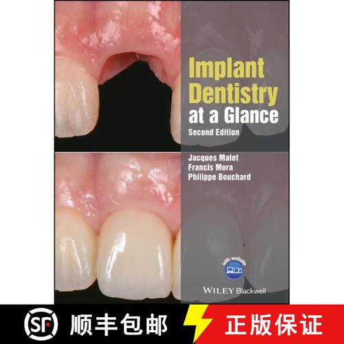 【3-4周达】Implant Dentistry At A Glance, 2Nd Edition [Wiley牙科医学] [9781119292609]