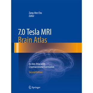 Correlation Brain 4周达 Cryomacrotome Atlas MRI Vivo 9783642543975 7.0 with Tesla