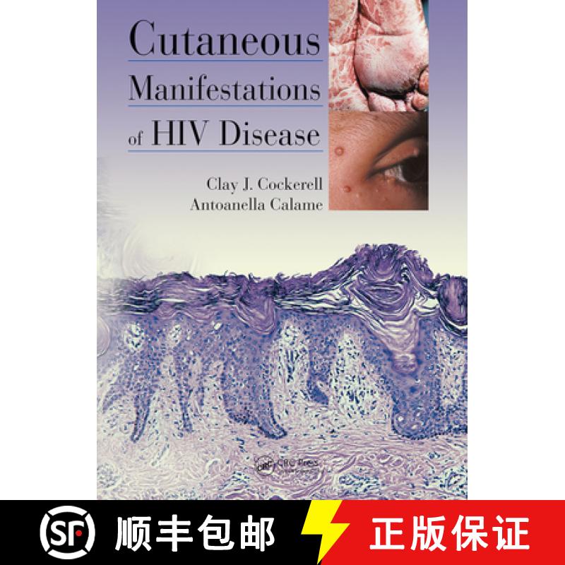 【3-4周达】Cutaneous Manifestations of HIV Disease [9780367452193]
