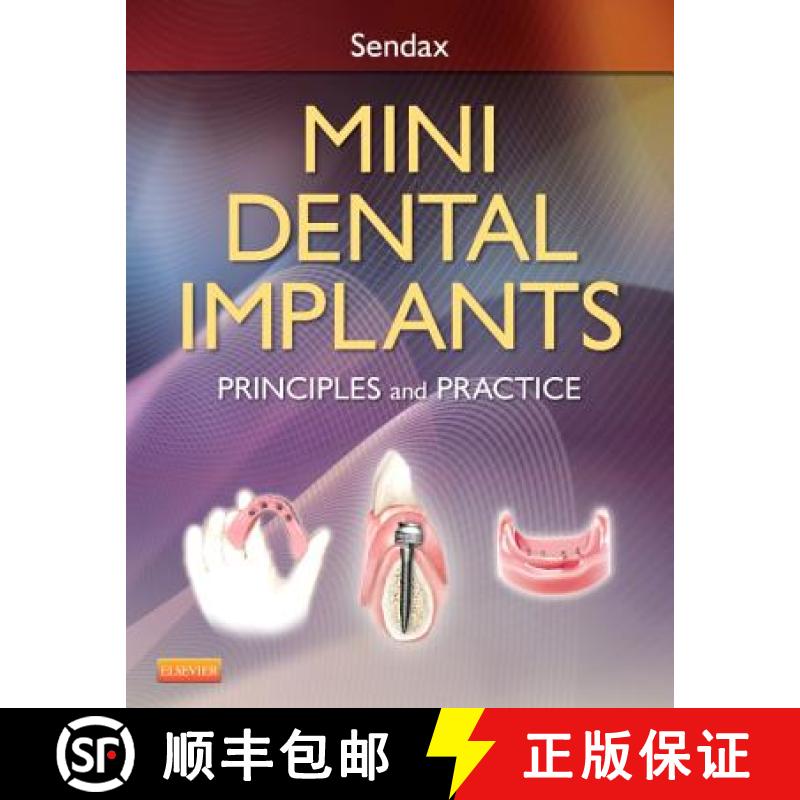 【3-4周达】Mini Dental Implants: Principles and Practice [9781455743865]