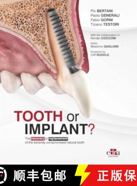 【3-4周达】Tooth or Implant? [9781957260525]