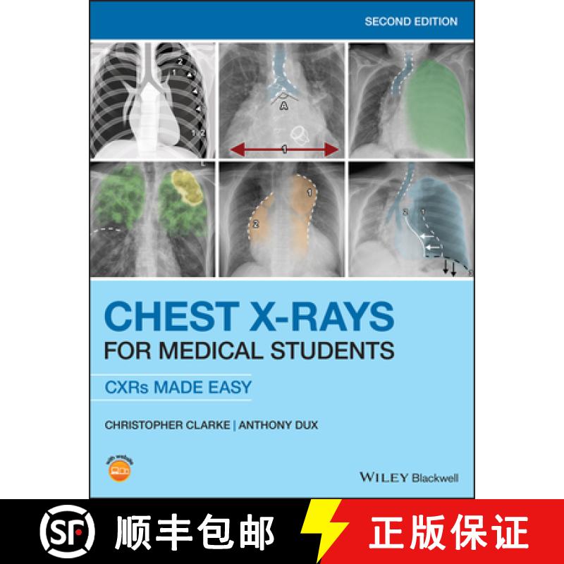 【3-4周达】Chest X-Rays For Medical Students - Cxrs Made Easy 2Nd Edition [Wiley医学] [9781119504153]