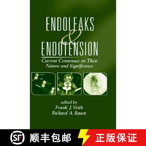 【3-4周达】精装 Endoleaks and Endotension: Current Consensus on Their Nature and Significance [9780824709549]